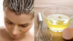 Home Remedies For Hair